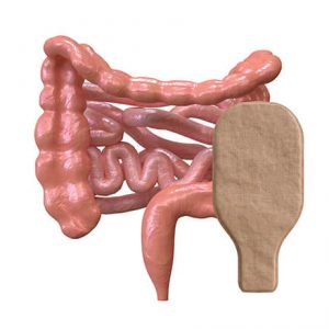 Stoma Care Course
